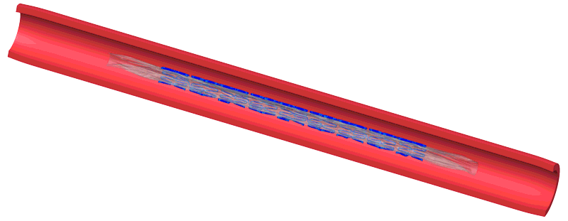 Simulation der Ballon-Expansion in einem Arterienmodell